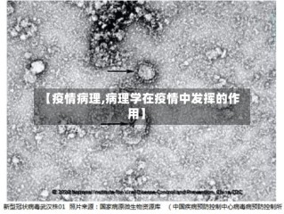【疫情病理,病理学在疫情中发挥的作用】