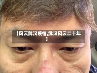 【风云武汉疫情,武汉风云二十年】