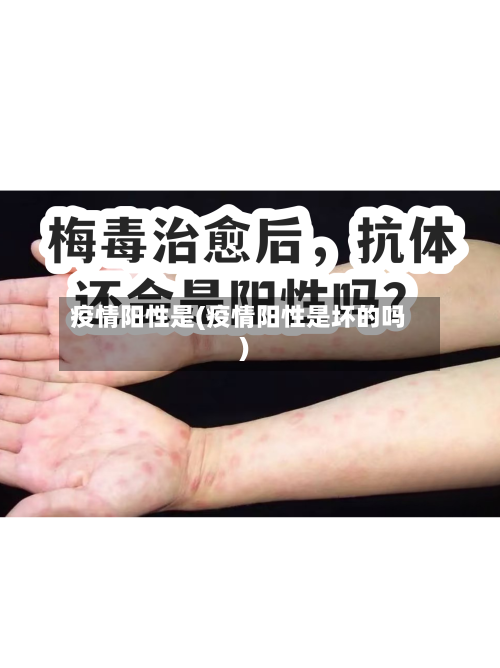 疫情阳性是(疫情阳性是坏的吗)-第3张图片